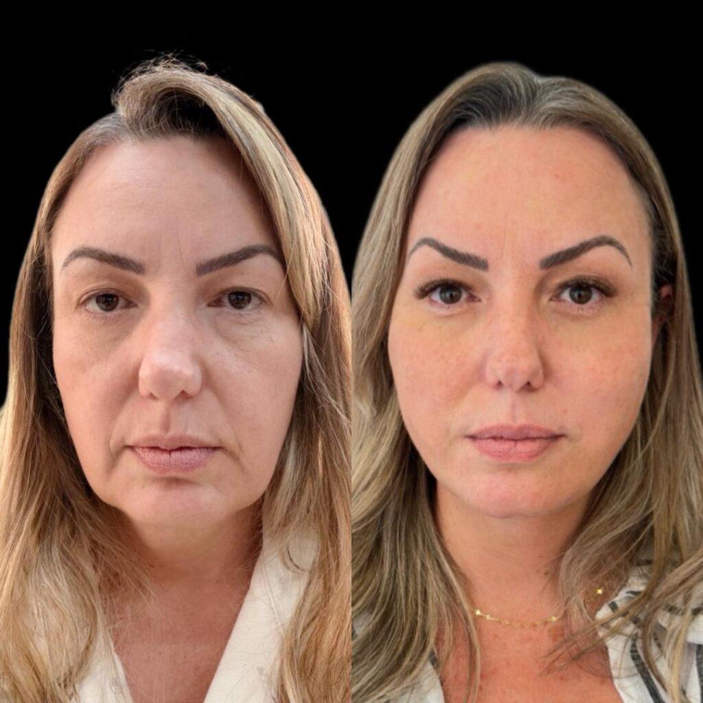 WhatsApp Image 2026-02-06 at 16.44.46